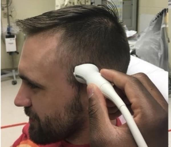 Transcranial Dopler (TCD) image